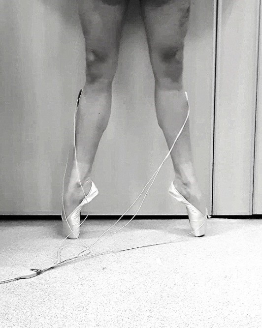 peroneus longus aktivaatio emg.jpg